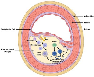 Immuno-modulatory role of baicalin in atherosclerosis prevention and treatment: current scenario and future directions